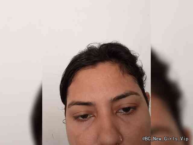 Rubella cam profile